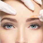botox